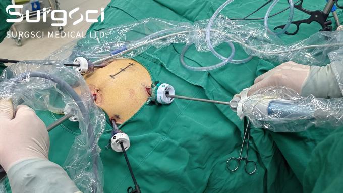 에 대한 최신 회사 뉴스 귀하의 국가에서 대리점이 되십시오 | SurgSci 0