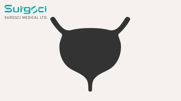 에 대한 최신 회사 뉴스 방광 결핵의 임상 분류  0